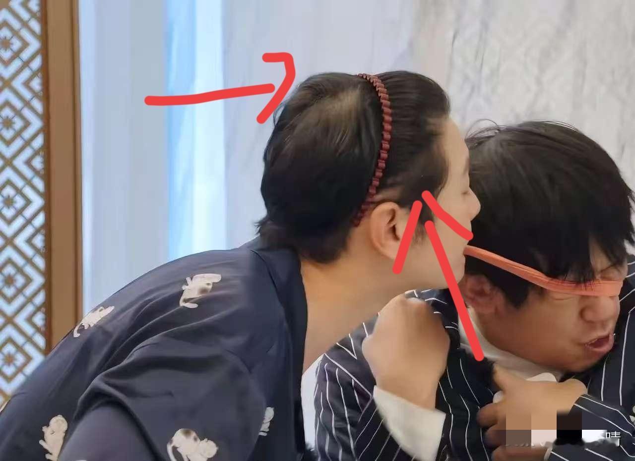 不知道大家发现没，黄晓明有一个很奇怪的地方那就是在出席活动的时候，头发茂密，