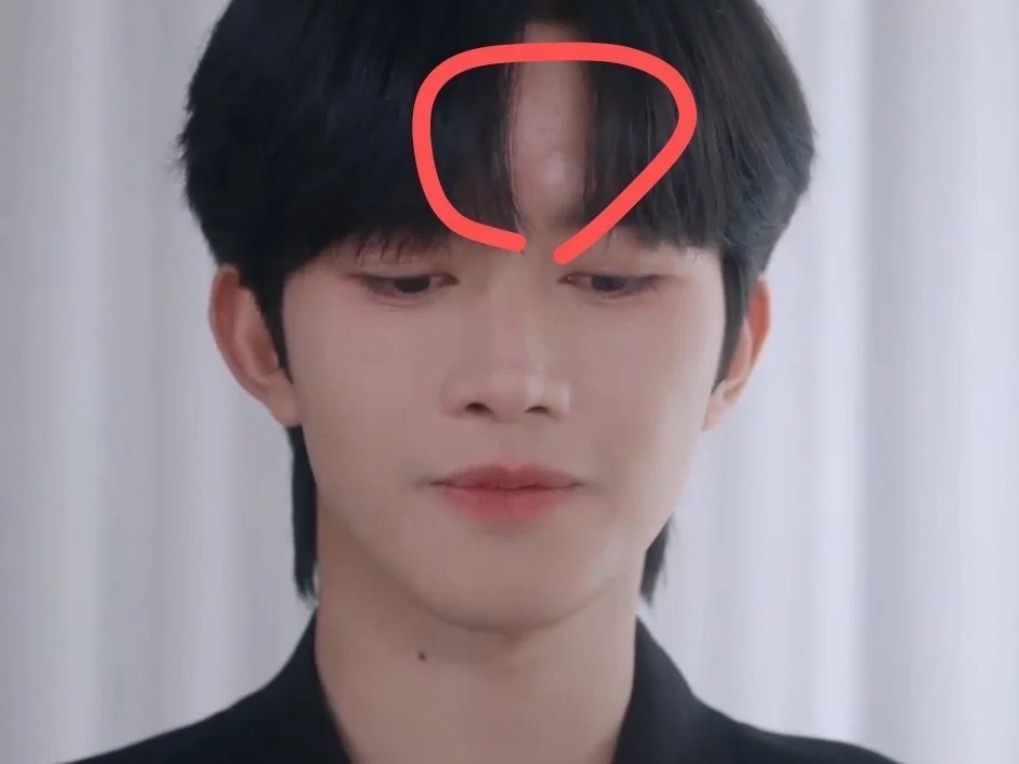 化妆师你睡了吗有没有人管管黄星的蚊子包​​​