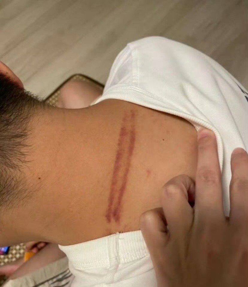 男朋友脖子上发现这个​😳​​​