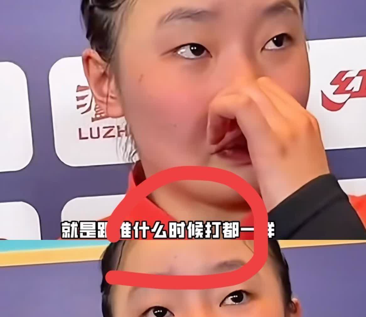 看张本美和打削球手真是急得我直跺脚！对面金琴英就跟算准了似的把球往她难受的位置喂