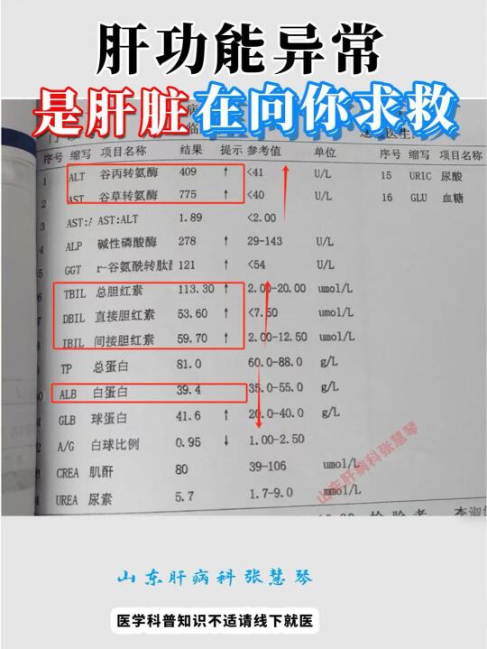 肝功能异常，这是肝脏在向你求救！ 门诊上来的病人，大都是从发现自己肝功...