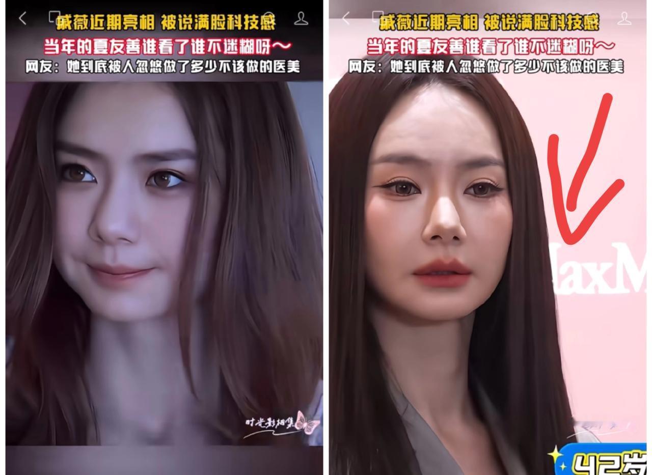 42岁的戚薇演技好不好，我不做评价，但是有一点不得不说，她的脸，有一个十分严