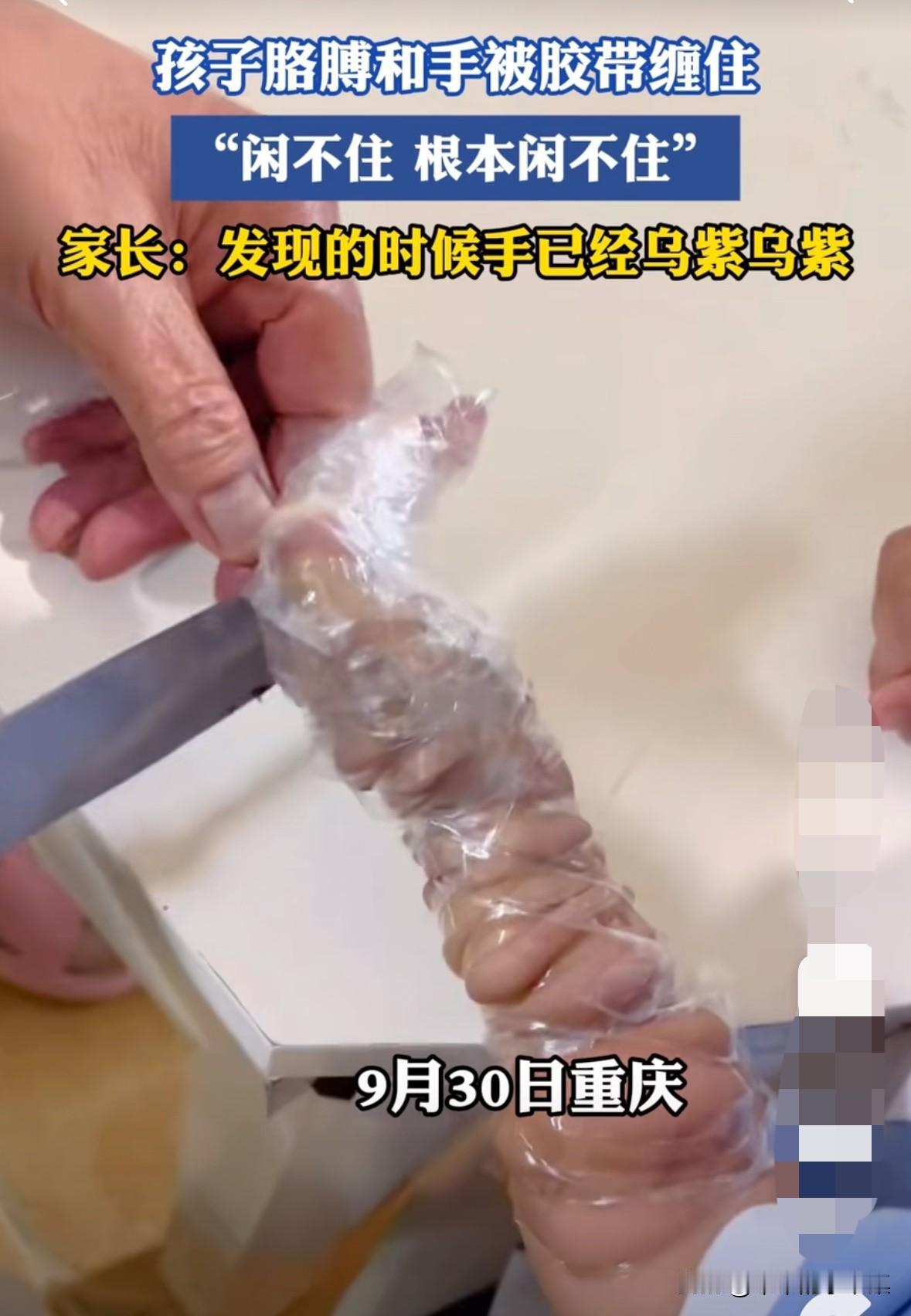 孩子玩胶带，把自己的手，胳膊全缠住了，家长发现的时候胳膊已经变得紫黑色了！这家