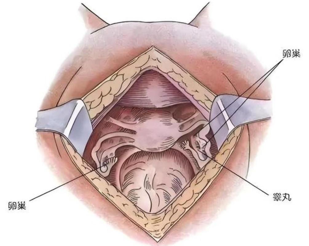 1965年，重庆一“女子”拥有两套生殖系统，她十八岁先是嫁老公生下一子，后竟然