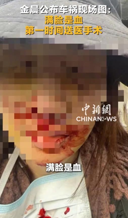 金晨道歉，有两点非常聪明，简直是公关界的绝对王者。 最近演员金晨出了个单车事