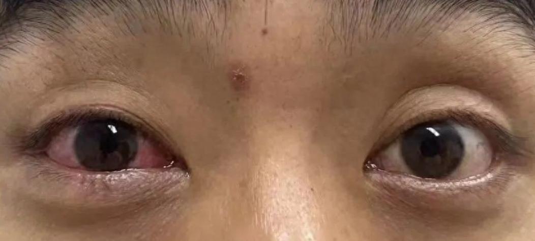 “不作死就不会死！”浙江杭州，男子到户外爬山，期间在草丛里看到一条五步蛇，换成别