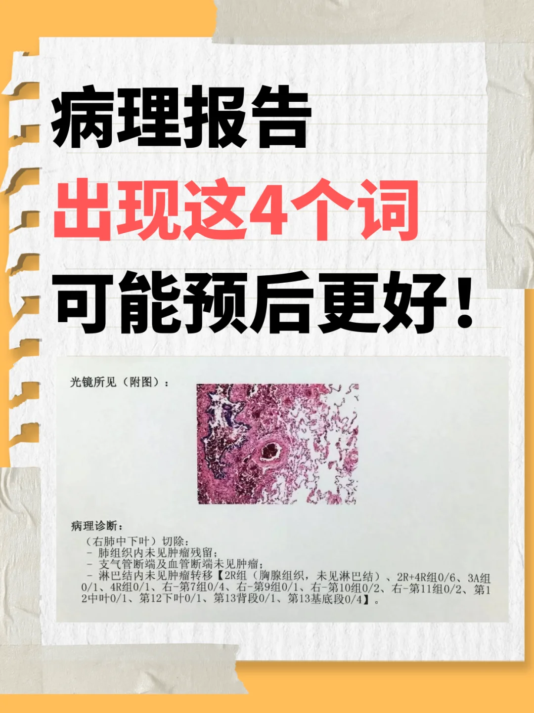 病理报告出现这4个词，可能预后更好！