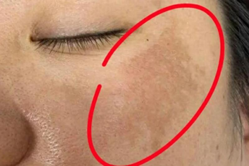 一个可以美容的中成药，气血通了，淤血除了，皮肤干净脸上无斑了大家好，我是中医陈