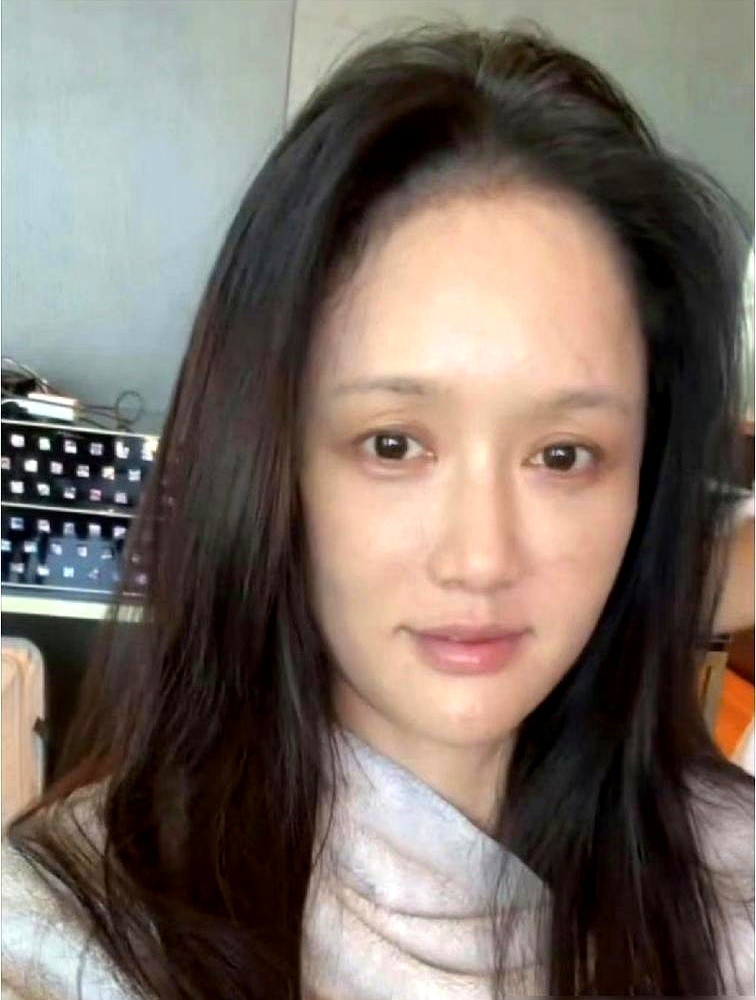 顶着稀疏的眉毛和黑眼圈，45岁的陈乔恩直接瘫在沙发上。照片一甩，评论区当场裂成两半。有人盯着她额头上