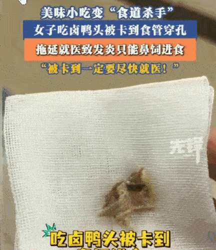 太大意了！昆明，一女子边吃卤鸭头边聊天，不慎被一小块骨头卡喉。她火速赶往医院，耳