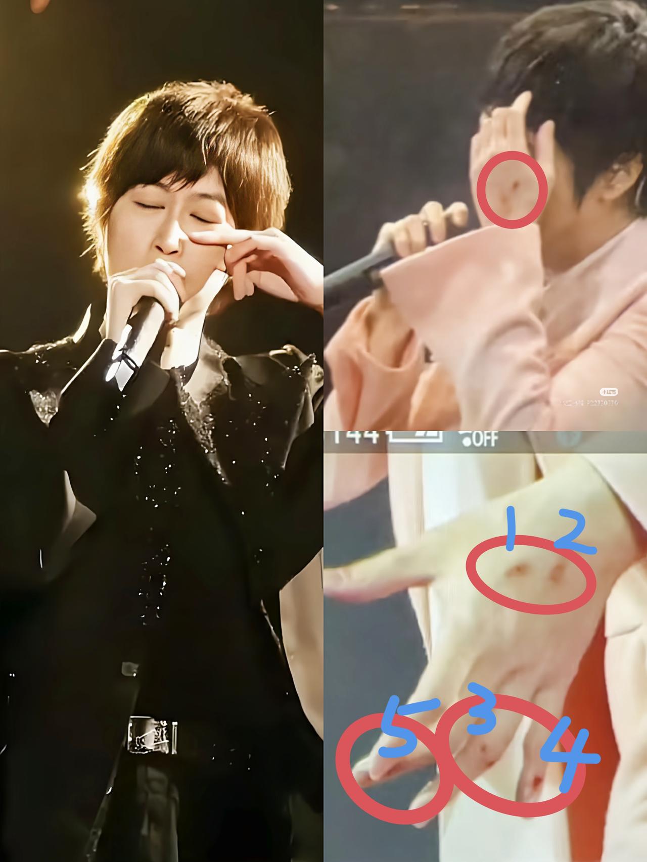 我闺蜜在看F4演唱会，她哭着跟我说，阿信摔了，根本不像网上传的那样，她亲眼看到