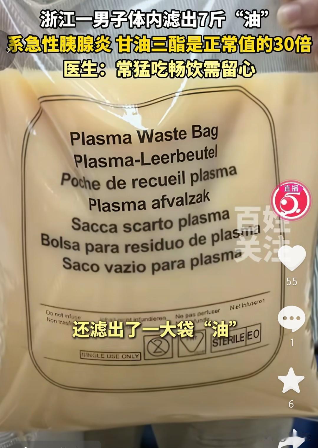 真不敢相信，这一大袋重7斤的油，是从一男子身体里抽出来的。浙江这位男子，因