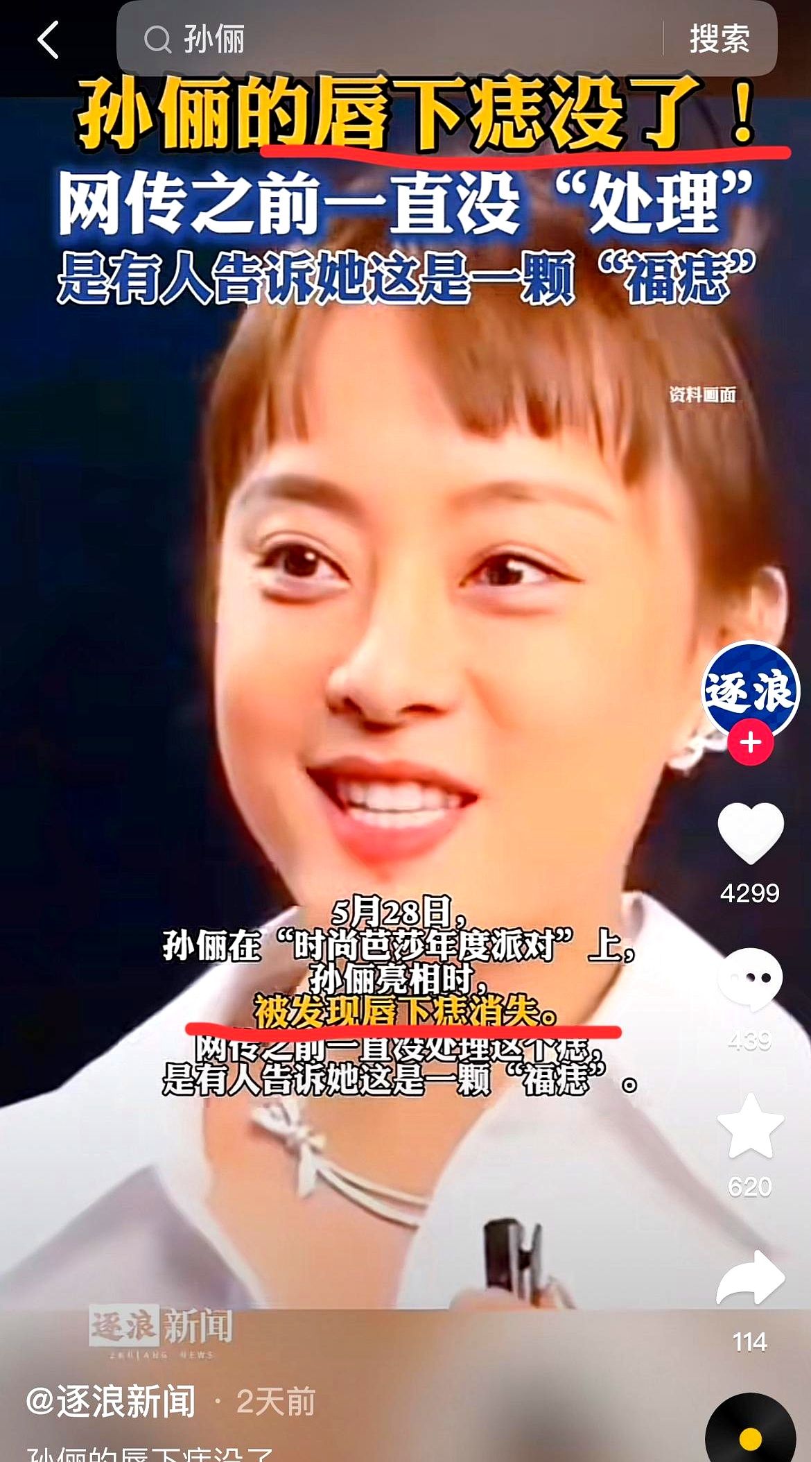 终于明白了孙俪点去唇下痣不是因为影响健康，而是因为影响上镜不过话说回来，