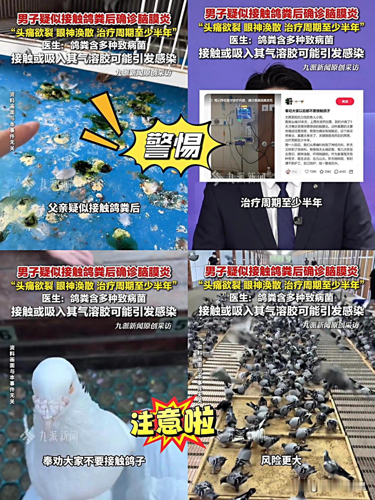 真是万万没想到，浙江金华一位老人因长期接触鸽子粪便，头痛20多天后竟陷入意识丧失