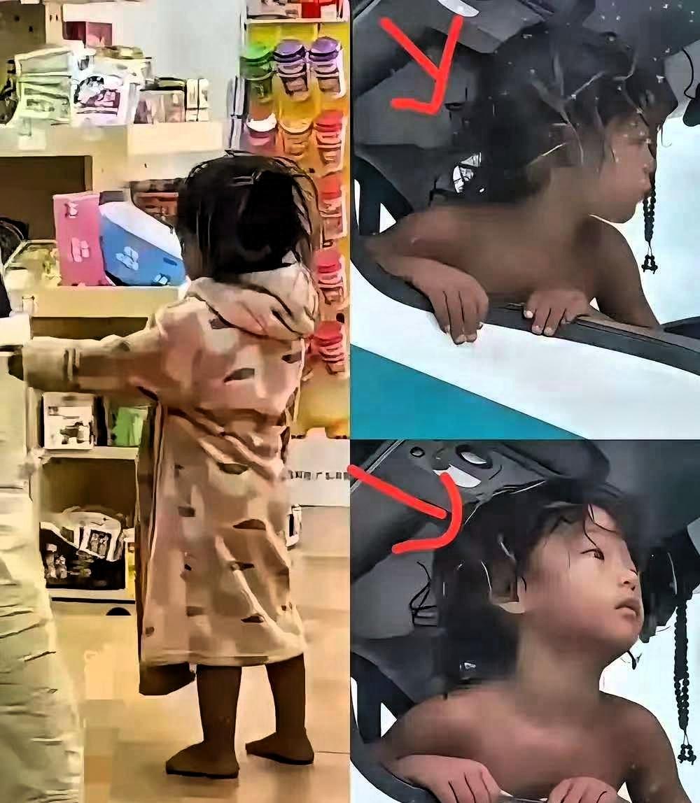 野人小孩”的体检报告出来了，情况有些不容乐观。佝偻病前期、严重营养不良，医生