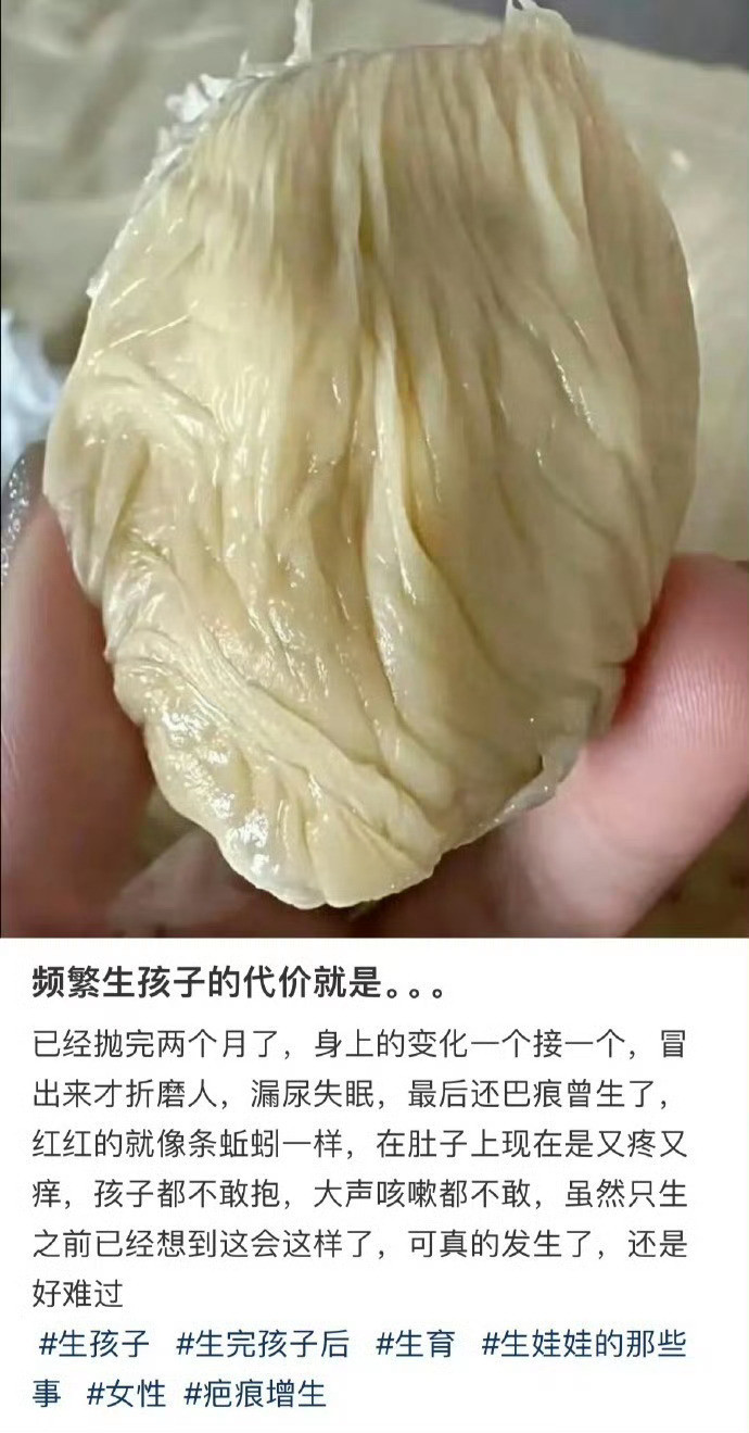 频繁生孩子的代价就是。。。​​​