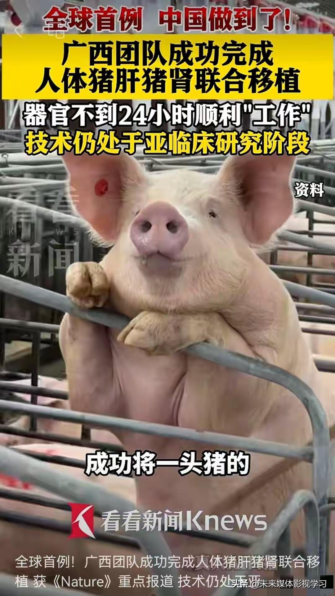 猪肝猪肾同时在人体内“上岗”，中国医生这波操作，让全球震撼！最近，国际顶尖期