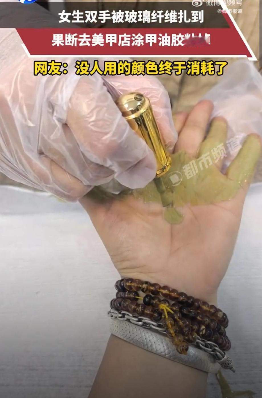 人怎么会这么聪明！浙江，一女生在家干活时，手不小心扎到了玻璃纤维，简单处理后发现