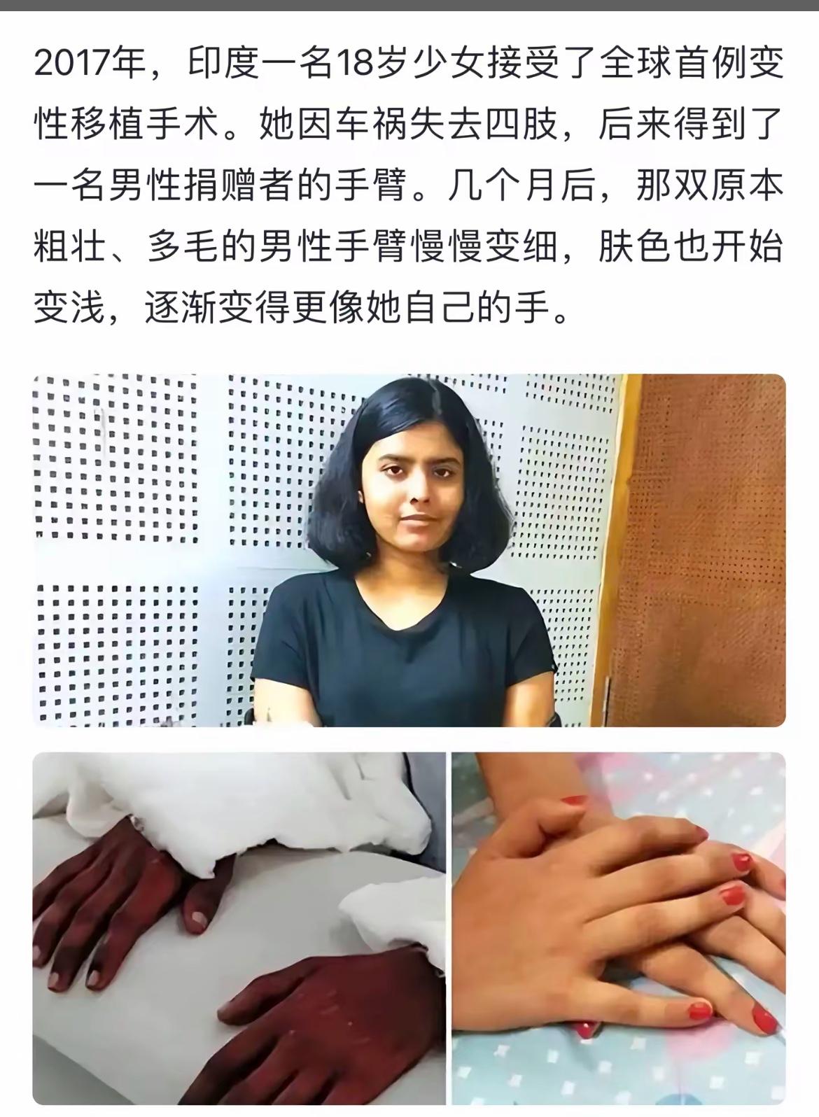 女孩接受移植手术，手臂逐渐恢复。