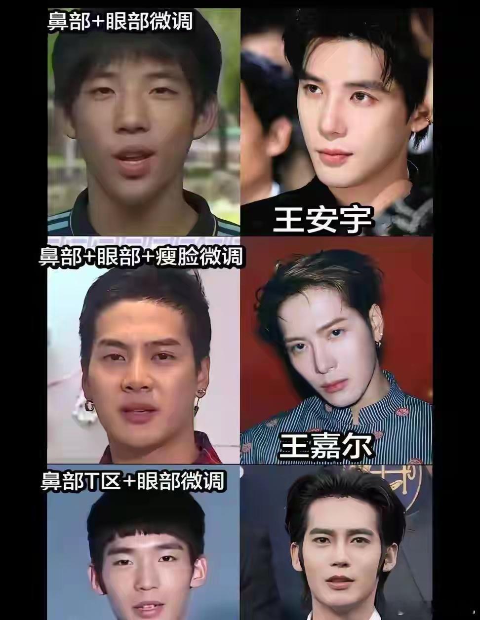 感觉明星其实都会做微调的