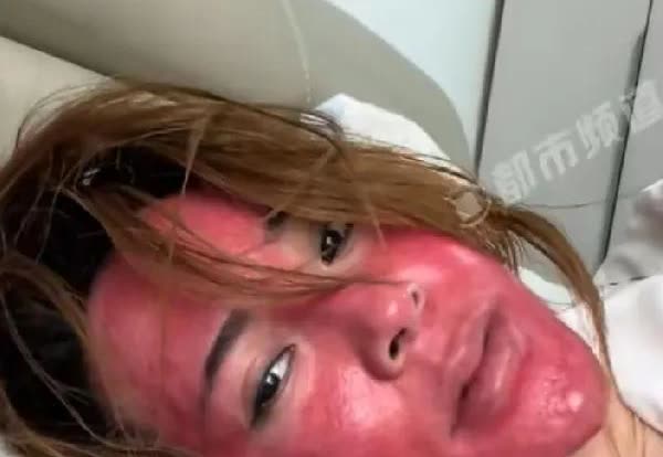 女子化妆22年脸红成“关公”给所有爱化妆的人提了个醒不是因为化妆导致的这