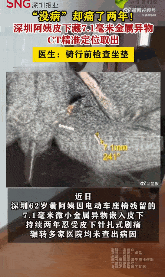无病一身轻！广东深圳，一62岁的阿姨这两年过得可谓是求生不得、求死不能，她隐私部