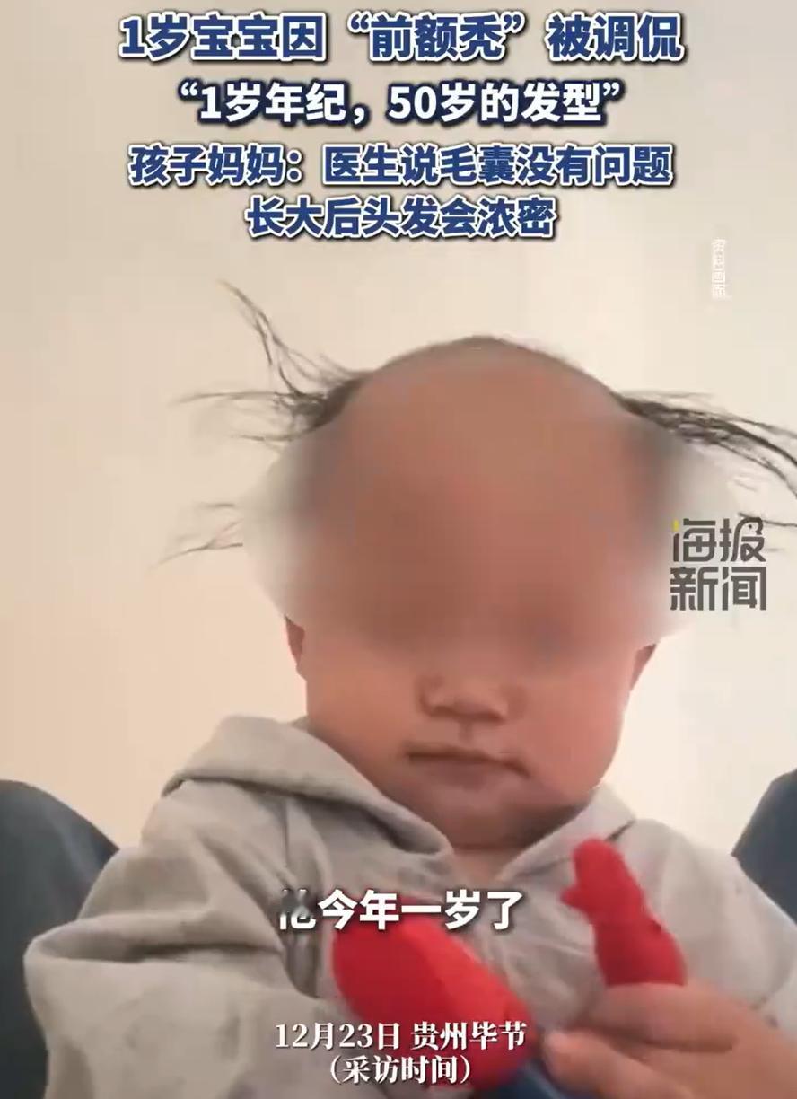 年纪轻轻的就一把年纪了！贵州毕节，一名一岁的男孩因为前额秃，被调侃1岁的年纪却有