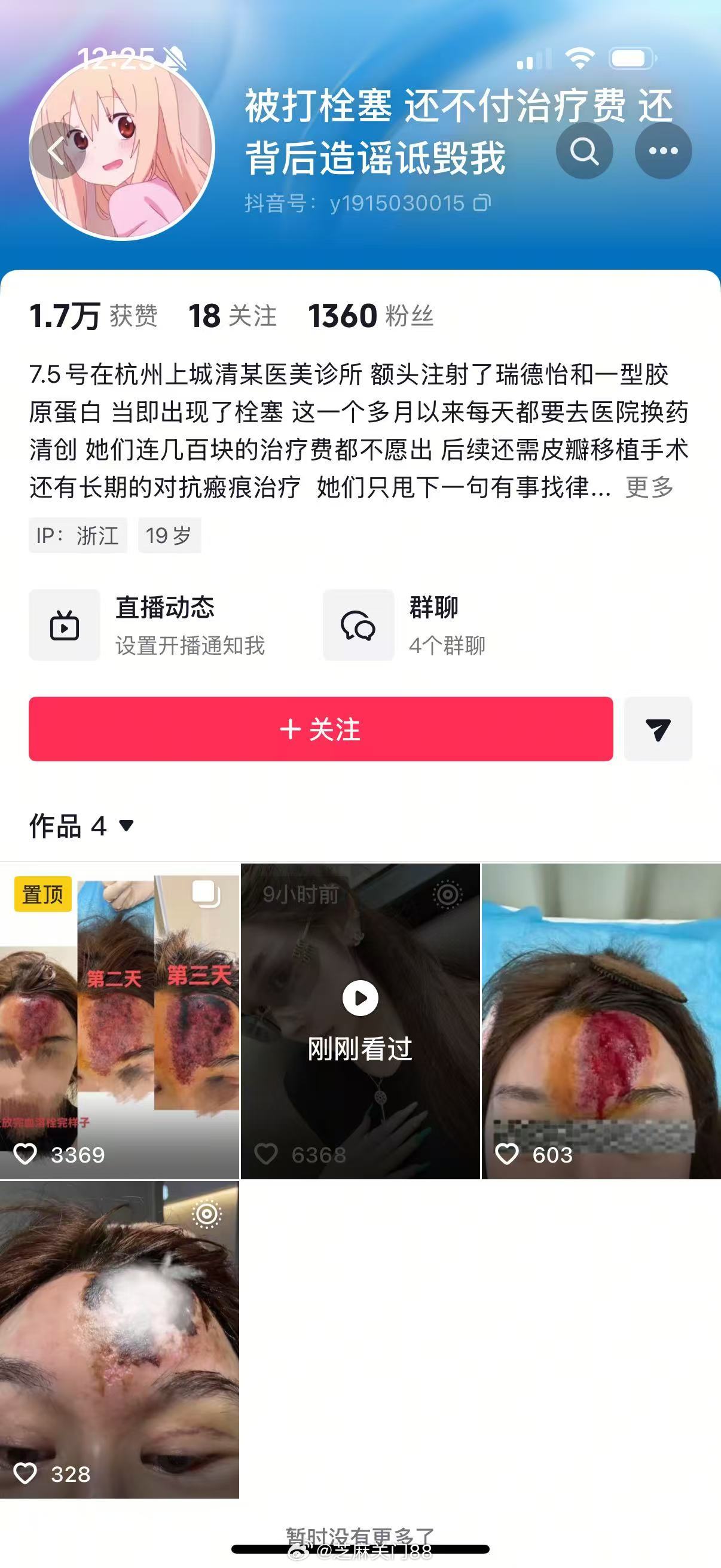 啊[笑着哭]​​​