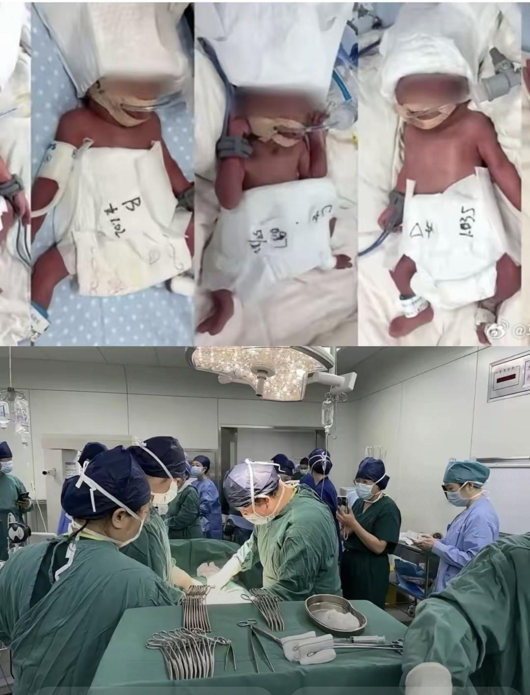 2月26号凌晨，新疆姑娘迪丽在武汉生下五胞胎。24岁，自然怀孕，孕不到29周，五