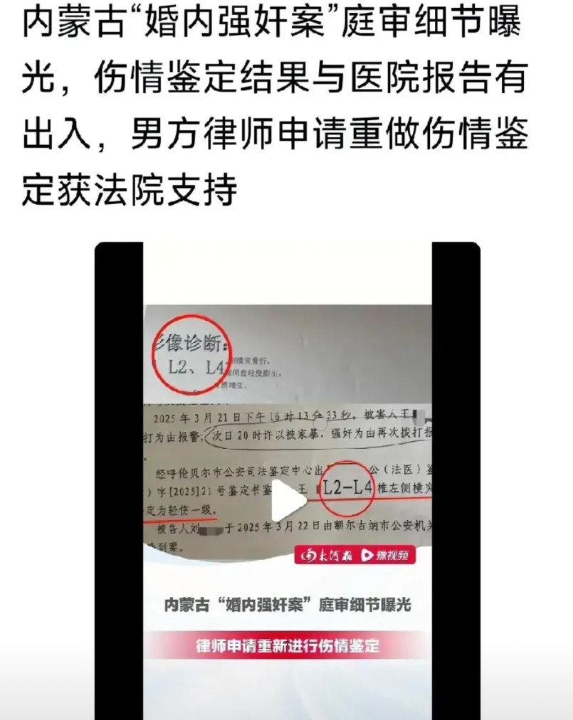 订婚强奸案可能出现反转。警方出具的伤情鉴定与医院的医学报告情况不符，结局或许谁都
