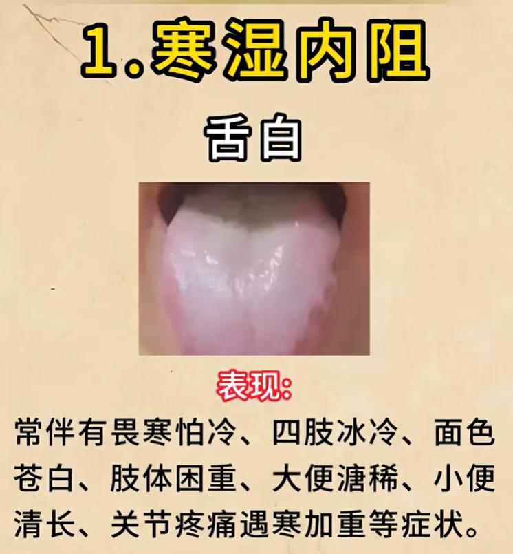 舌色发白分4种证型，对照舌象看懂自己的体质