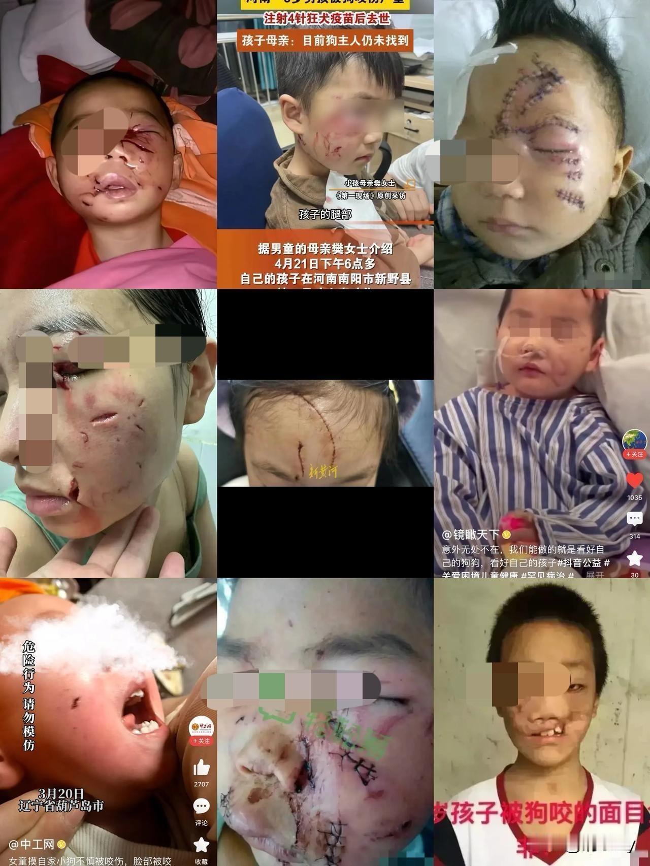 死了几条狗，被判了四年！如果狗主人给狗戴上嘴套也不至于此，具体拴没拴绳就更不好说