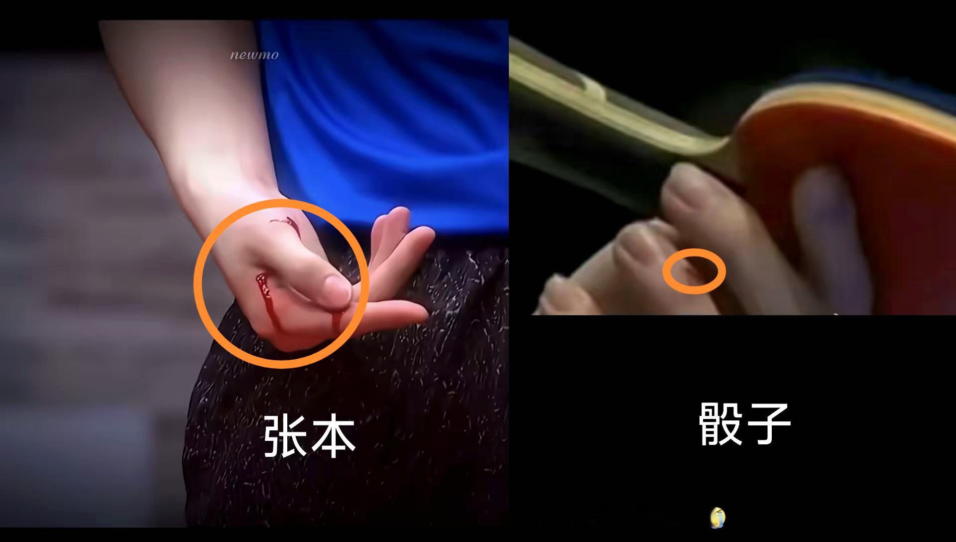 网友热议《张本和领菌手受伤反应》■张本手上明明是番茄酱，领菌受了内伤；■应该叫救