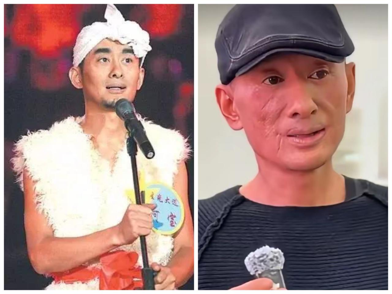 星光大道红起来的阿宝现在是这个样子了，岁月不饶人啊！