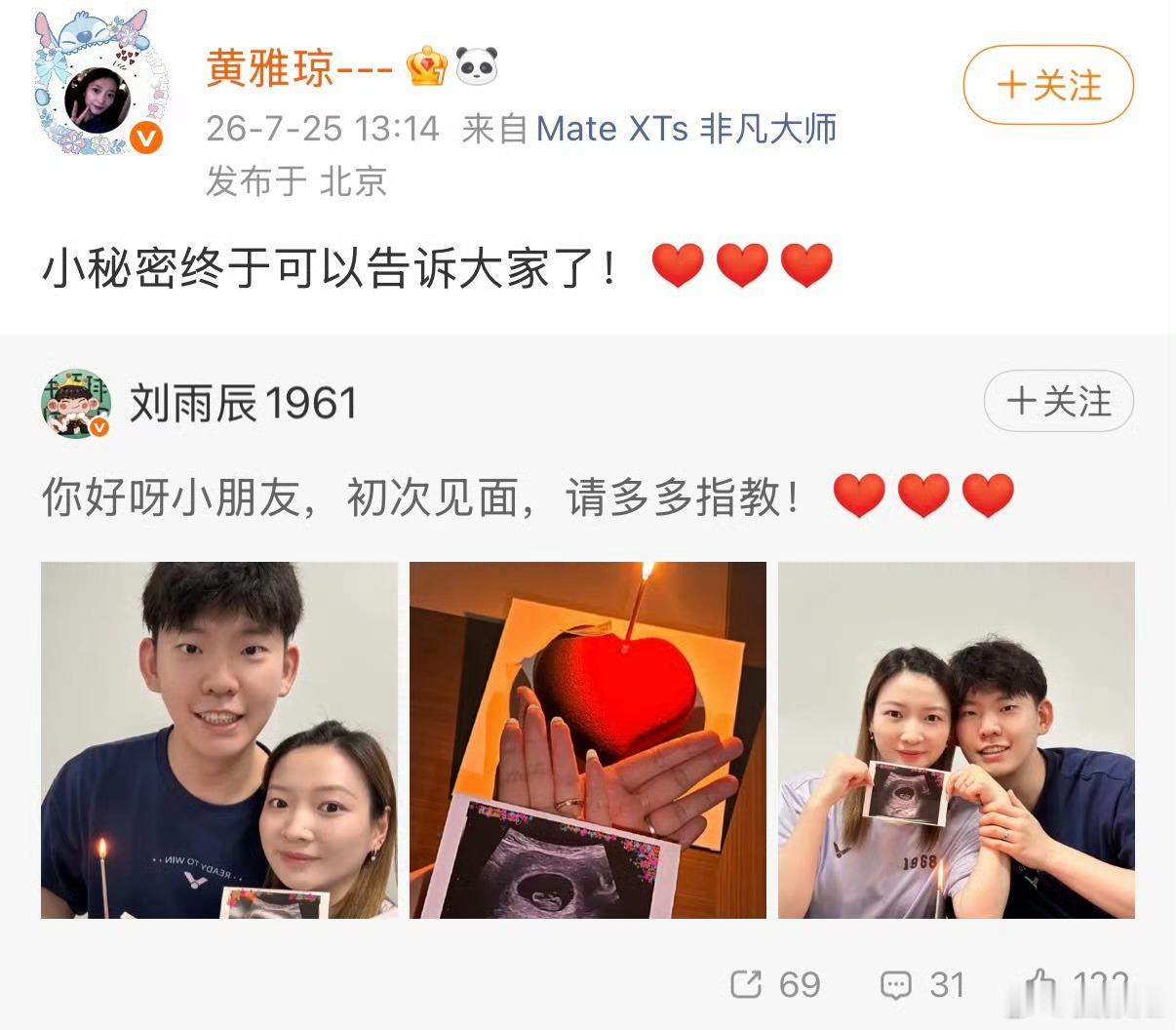 黄雅琼晒怀孕b超照好消息来啦黄雅琼姐姐怀孕了