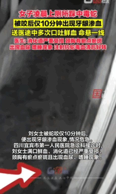 云南，60岁女子凌晨上厕所踩中毒蛇，仅10分钟后出现牙龈渗血！最可怕的是，女子并