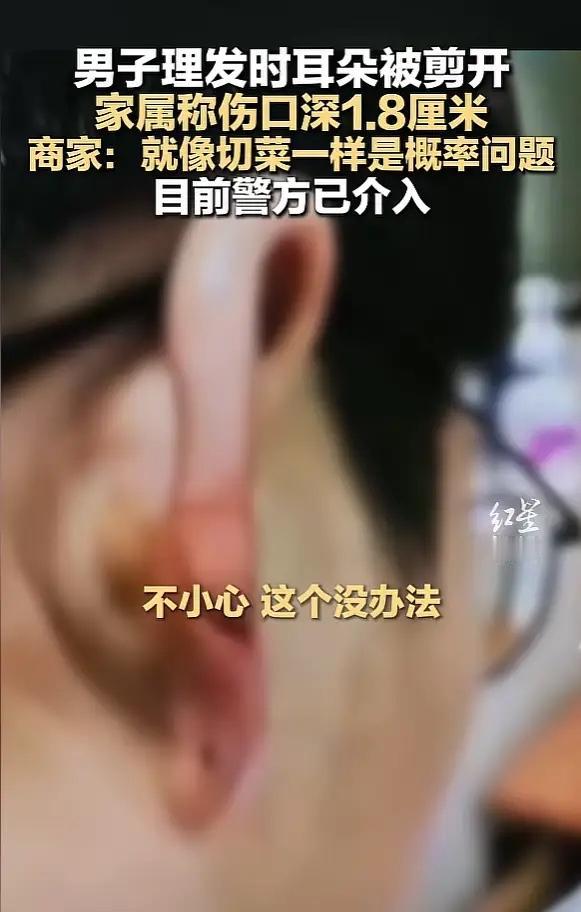 “看着都疼！”广东江门，一男子剪头发时，耳朵突然被剪刀划中，鲜血顿时流了出来，事