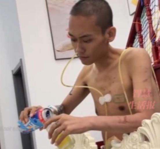 心酸!一名男子癌症晚期,他主动停止治疗,自己买来一箱啤酒喝,医生看到后劝