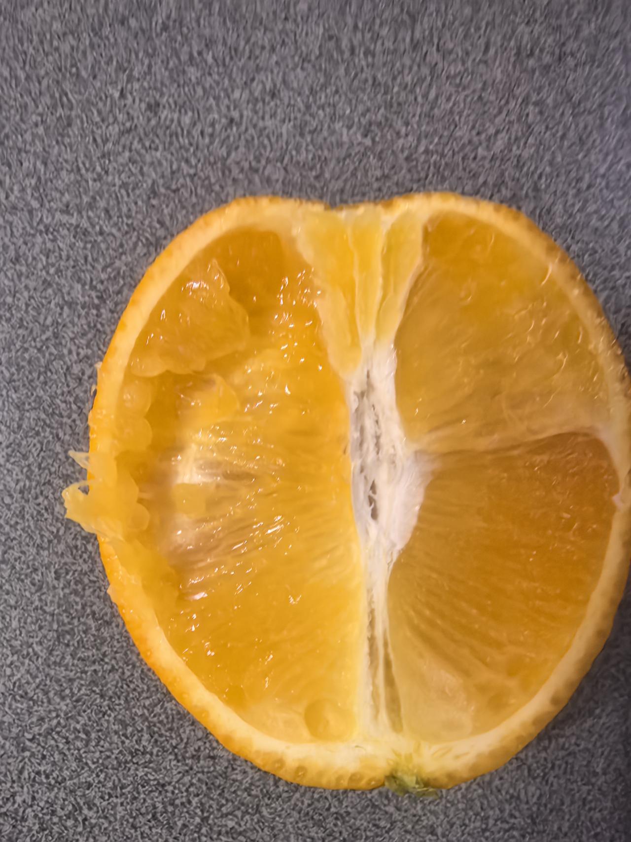 我爸昨天做了手术。髋关节翻修术。昨天下午出了手术台，重症监护室一夜。老公要打电话