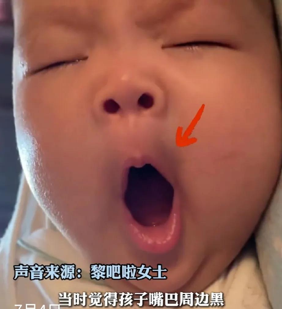 7月4日，陕西一宝妈总算找到了，把自己的宝宝变成“熊大”的原因了。原来太阳公公和