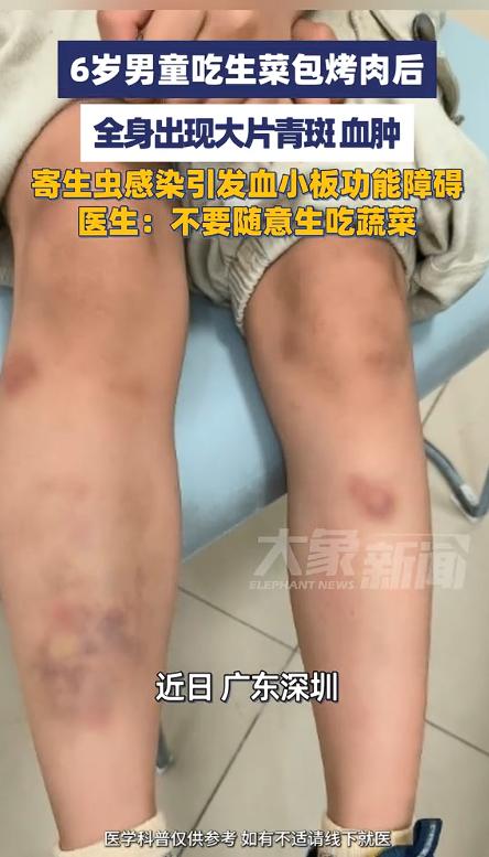 5月9日据大象新闻报道，广东深圳中山大学附属第七医院，一位家长抱着6岁儿子冲进急