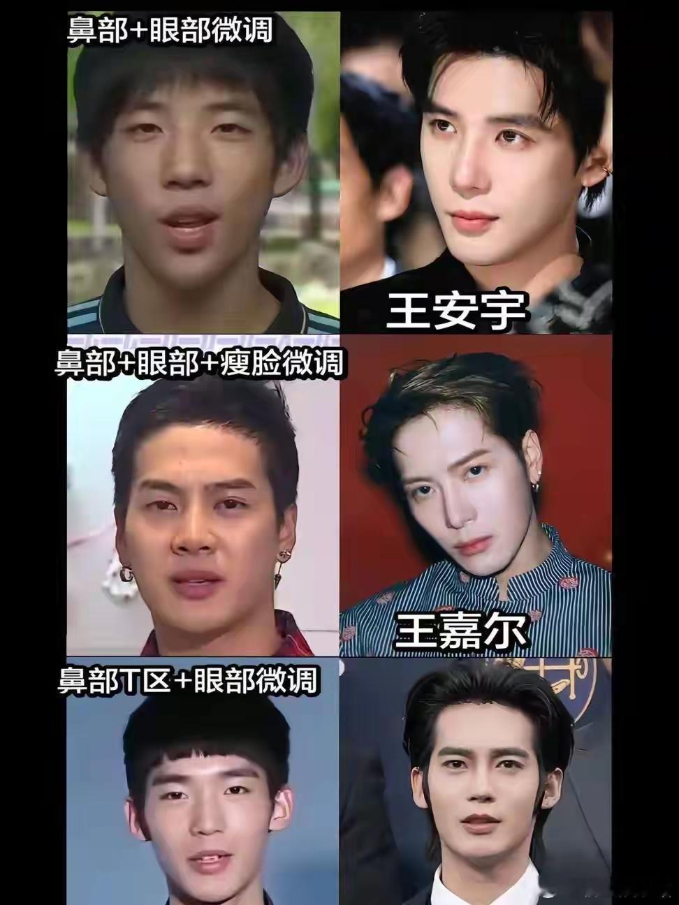 感觉明星其实都会做微调的