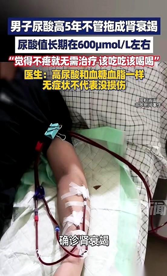 卧槽，真的悲剧了！我刷到个事儿，心头一紧，河南郑州一个四十来岁的大哥，腿肿得跟发