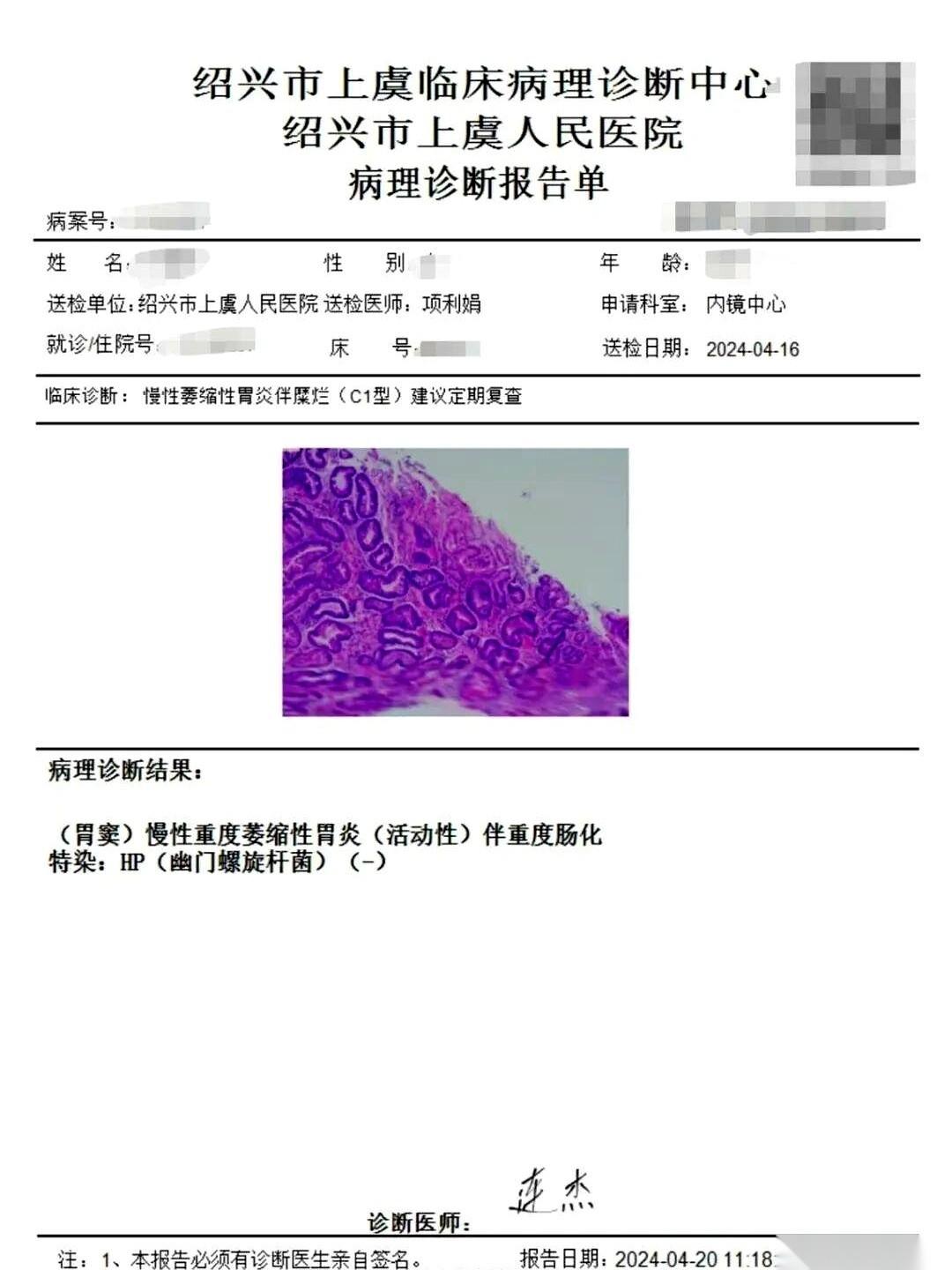 53岁，拿到一张胃镜报告单，上面俩字儿，特别刺眼——“重度”。胃黏膜重度萎缩，