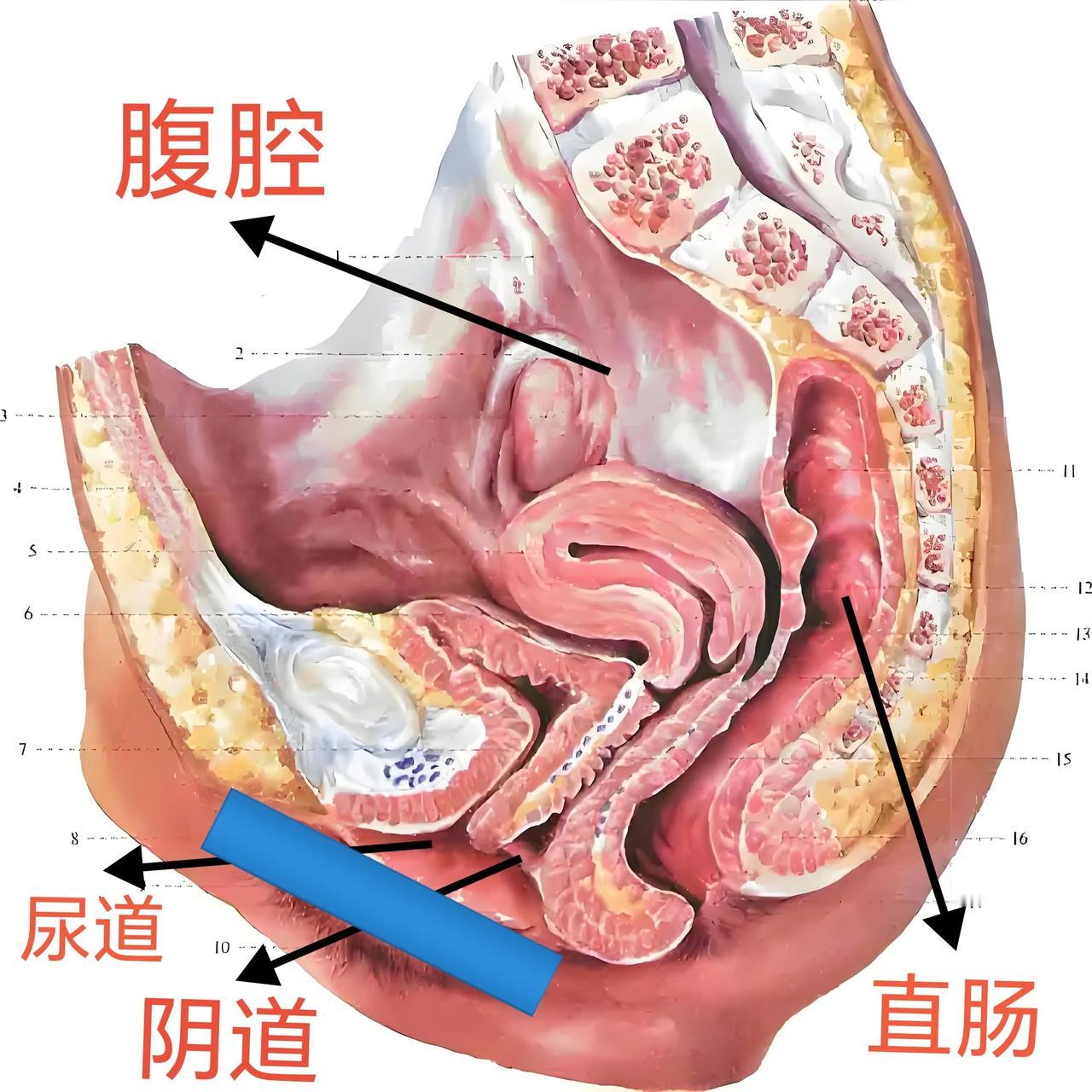 畜牲！😡印度女子，被丈夫“强暴”致死！事情发生在2017年12月，神