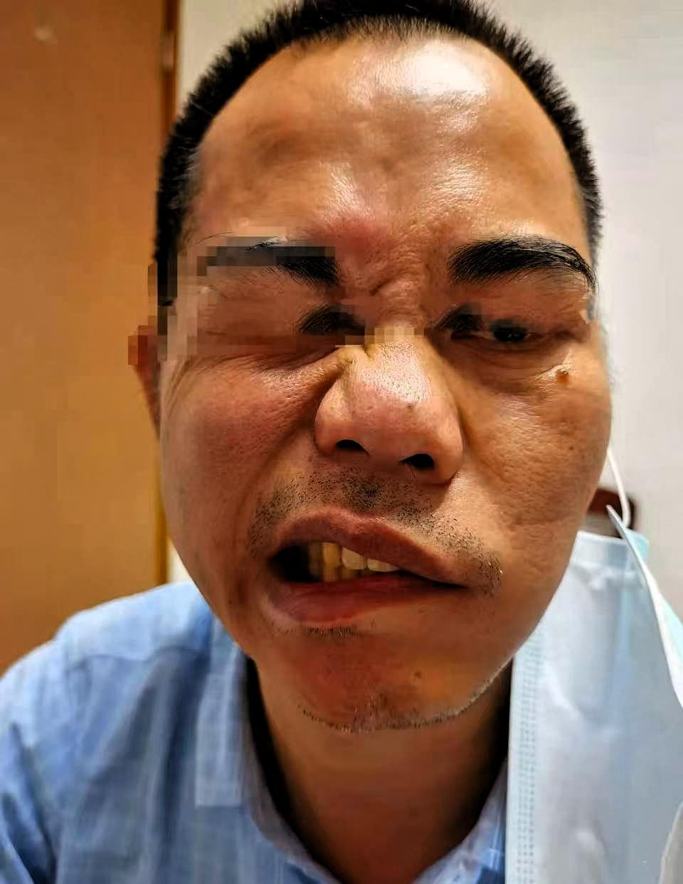 昨晚太热了，50多岁的大哥，不舍得开空调，对着风扇直吹了一整晚！大哥多年作