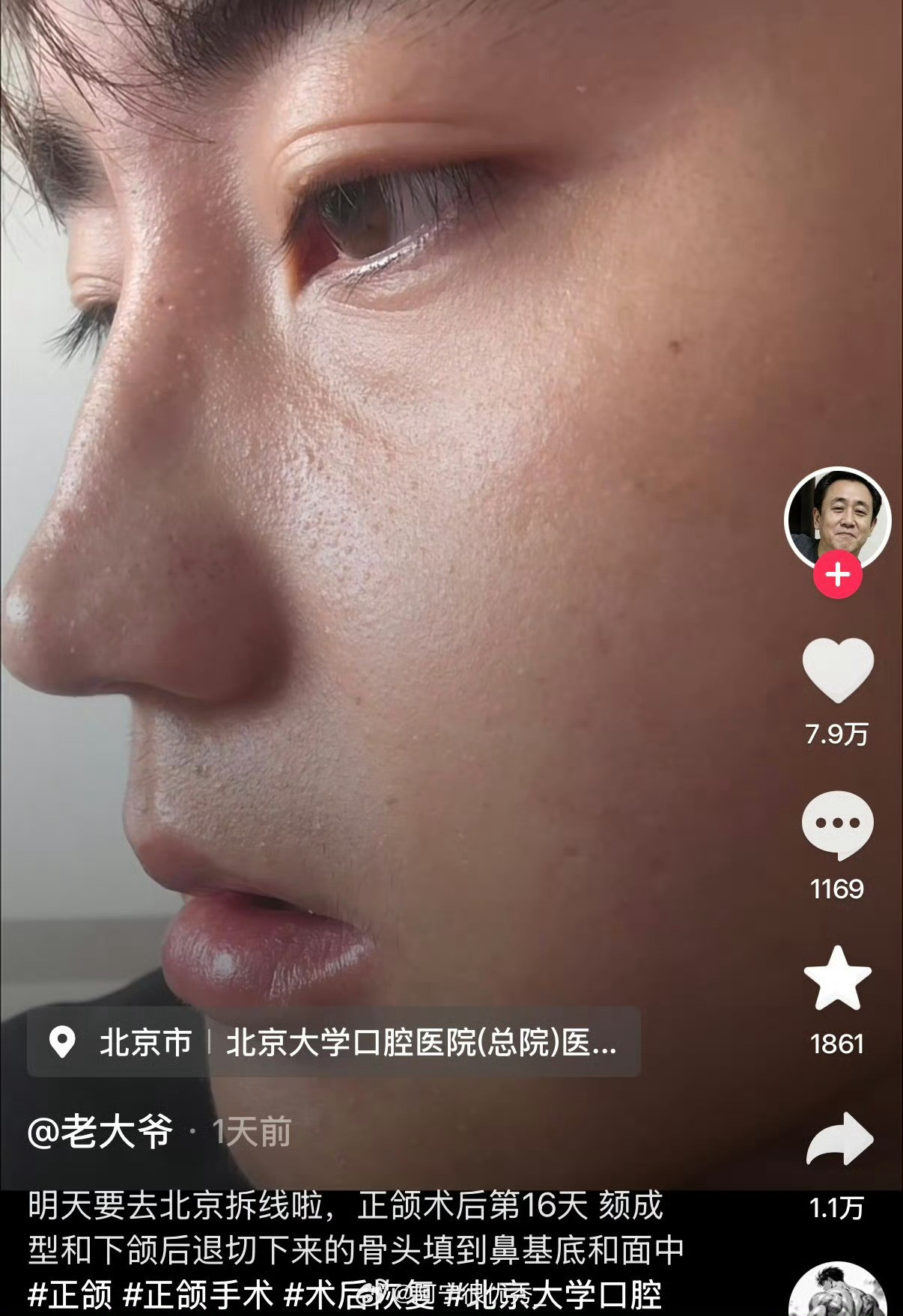 这简直是重生....医生技术太牛了吧​​​
