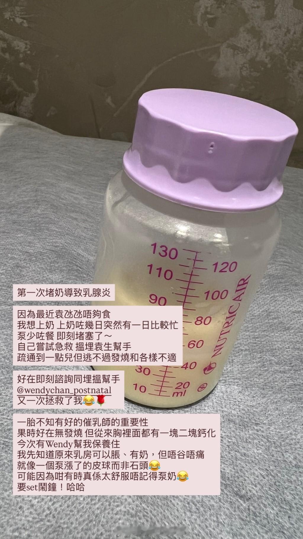 星岛：张宝儿自爆患乳腺炎发高烧老公袁伟豪出手搓奶仍乳腺堵塞揭乳房一直胀痛如石