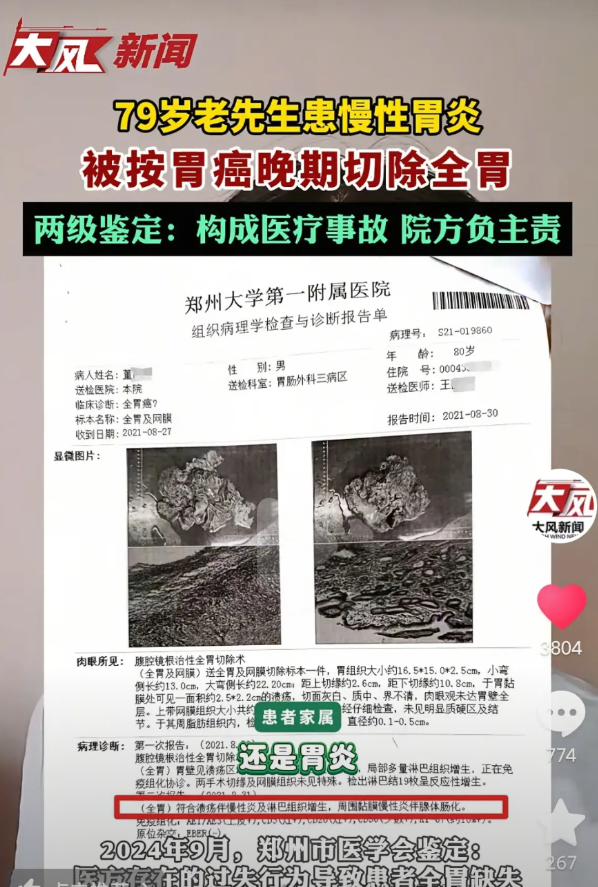 一觉醒来，这医院出名了，为了挣钱不择手段！79岁老人做了胃镜活检，坐诊医生说是