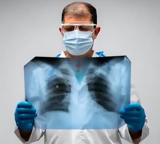 寿命长的慢阻肺患者，大多有5个共性！若你占一个，就值得高兴慢阻肺这个病，一听